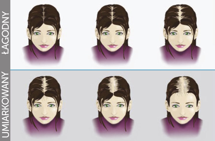 etapy lysienia kobieta